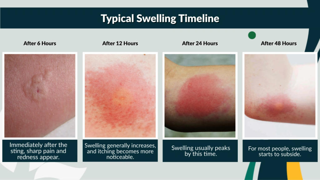 Typical Swelling Timeline