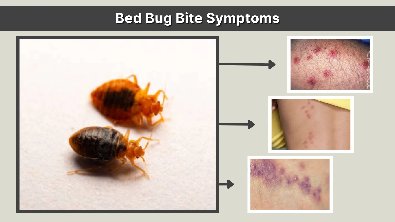Bed Bug Bite Symptoms Identification & Reactions