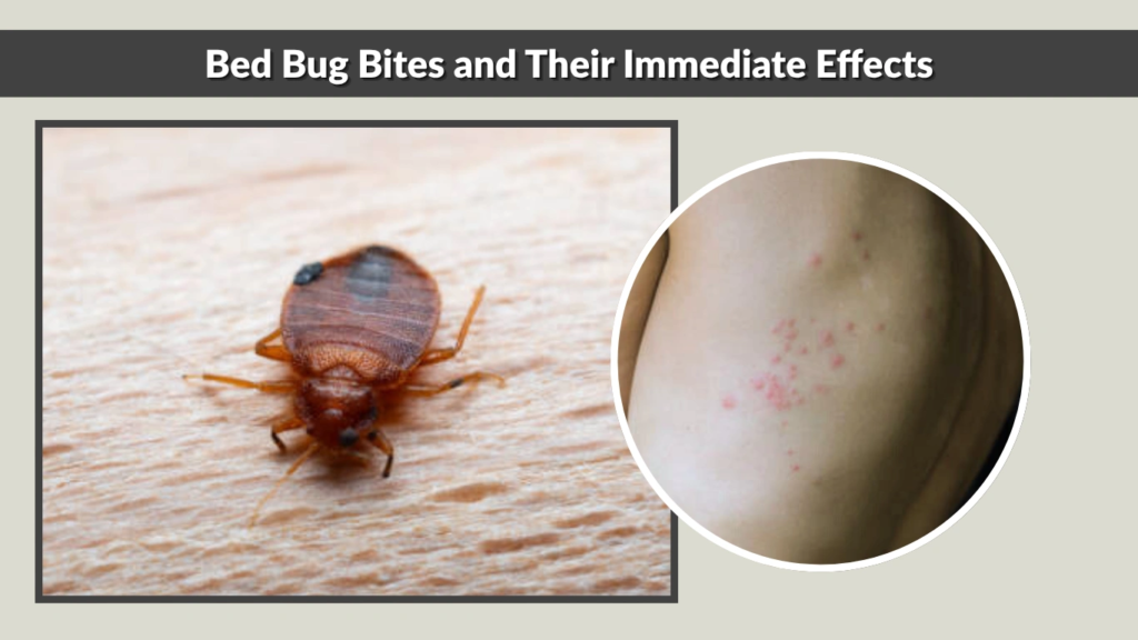 Bed Bug Bites and Their Immediate Effects
