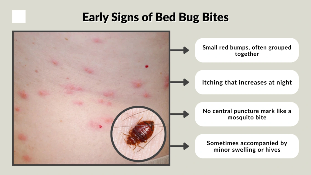 Early Signs of Bed Bug Bites