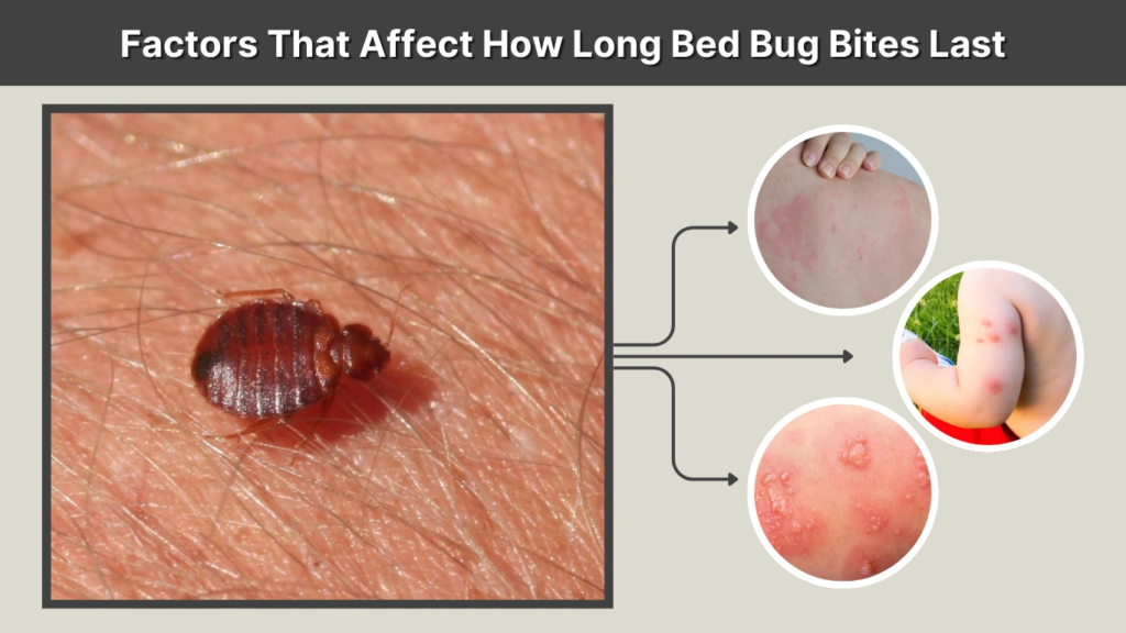 Factors That Affect How Long Bed Bug Bites Last