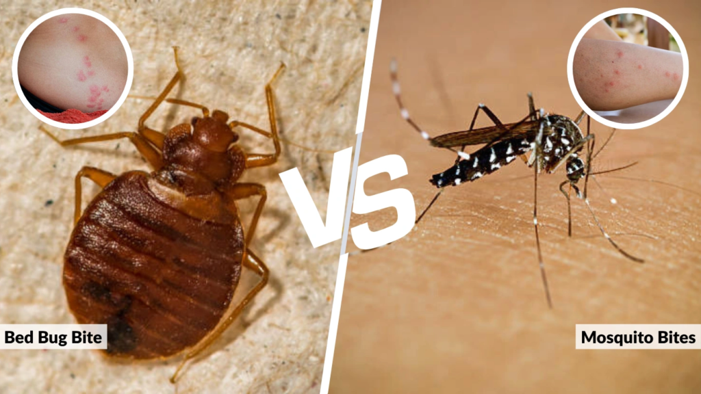 Bed Bug Bite Symptoms vs. Mosquito Bites