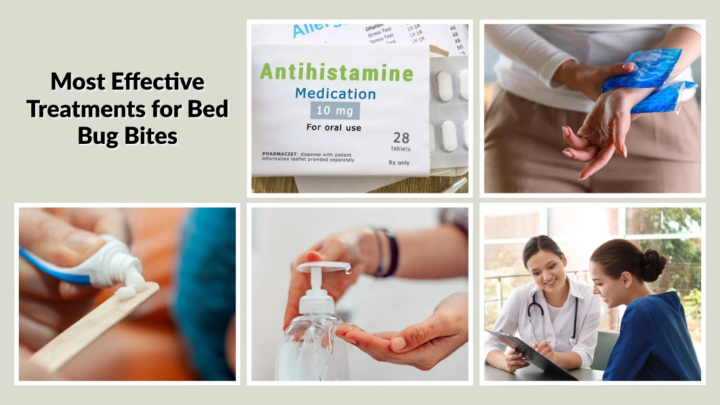 Most Effective Treatments for Bed Bug Bites