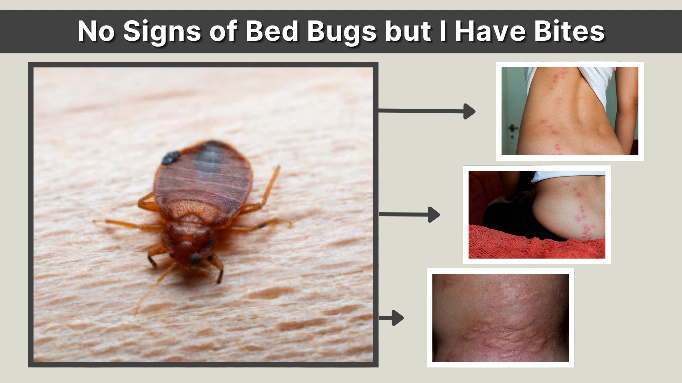 No Signs of Bed Bugs but I Have Bites Causes & Pictures