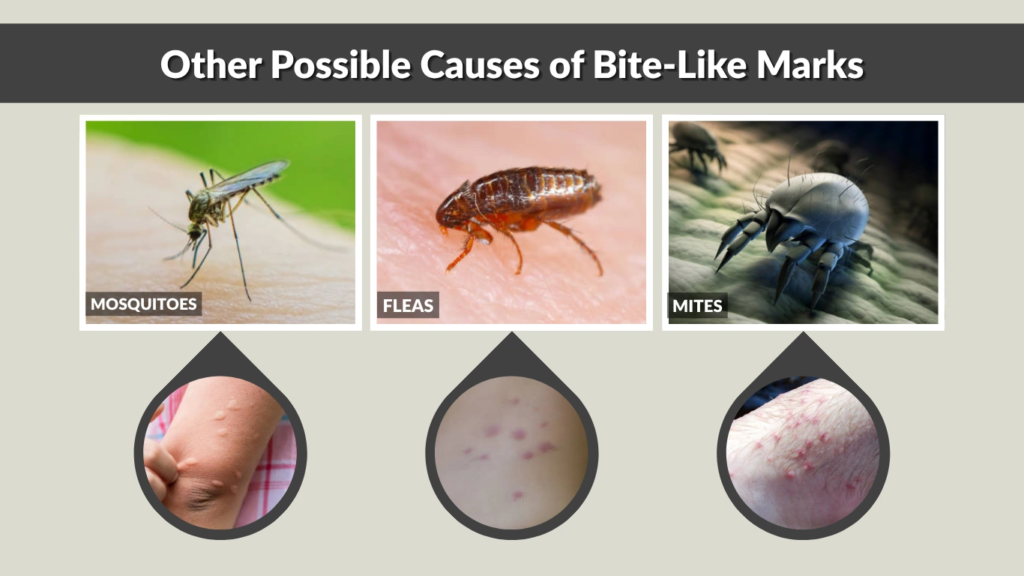 Other Possible Causes of Bite-Like Marks