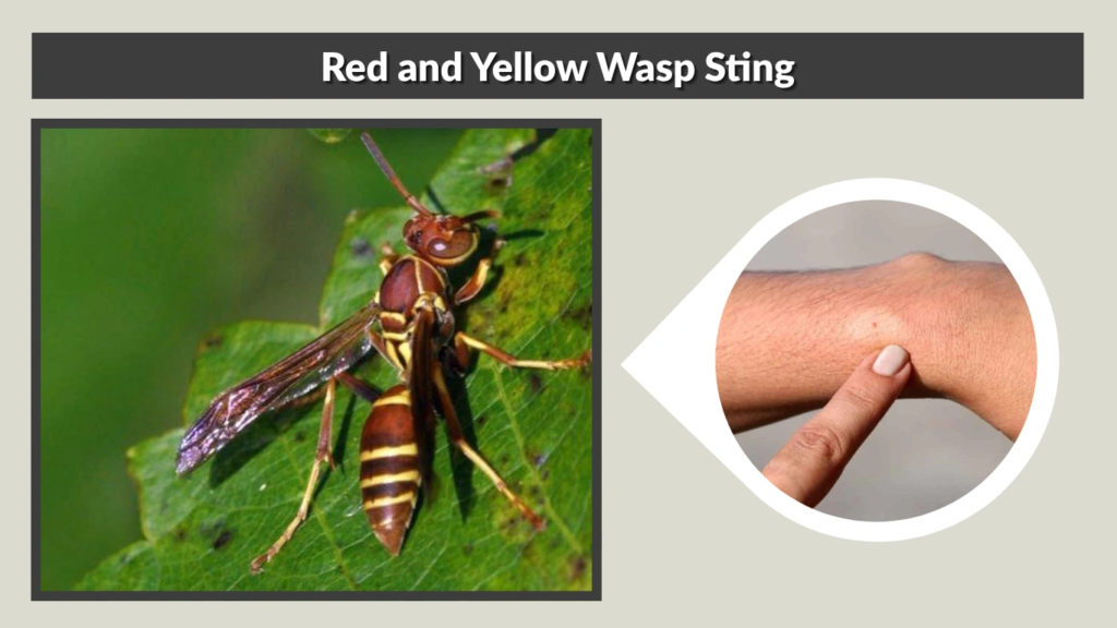 Red and Yellow Wasp Sting