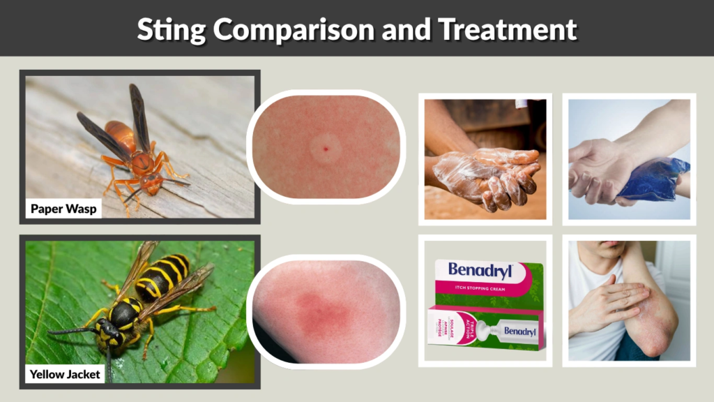 Sting Comparison and Treatment
