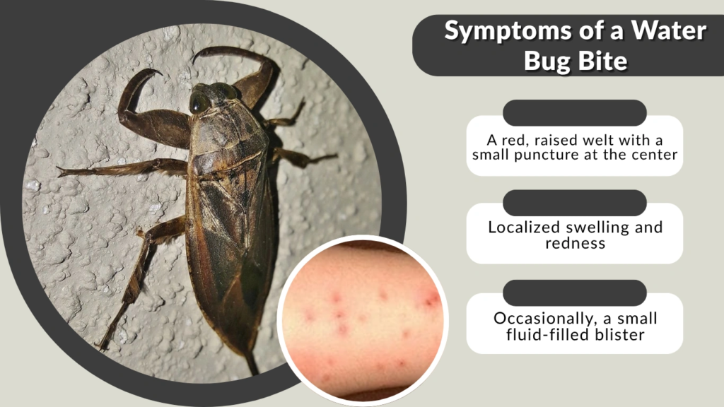 Symptoms of a Water Bug Bite