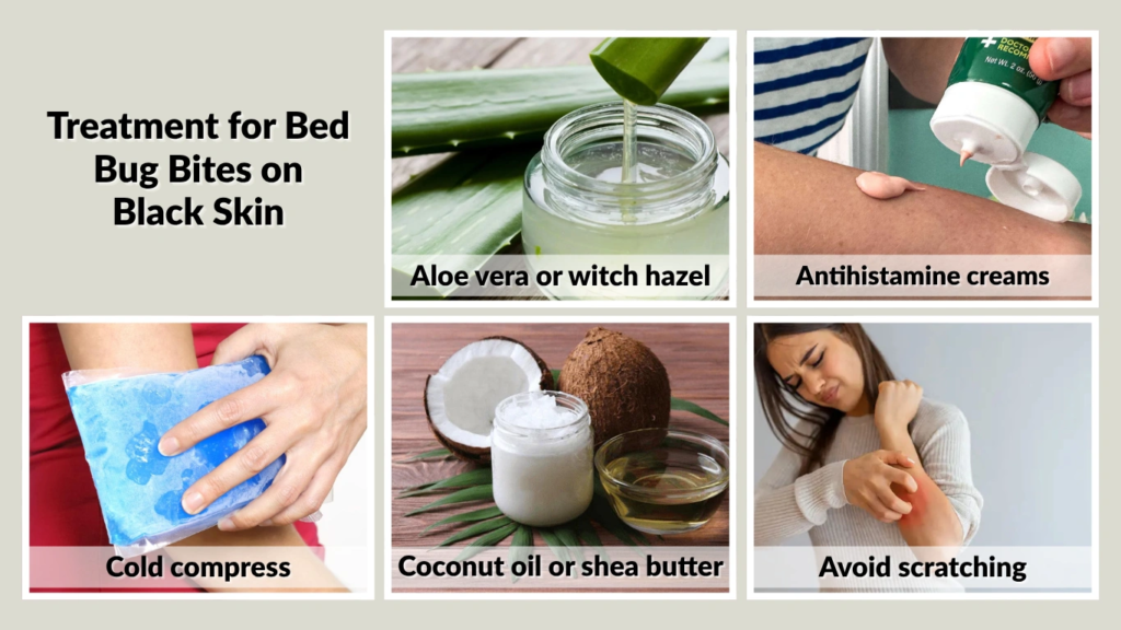 Treatment for Bed Bug Bites on Black Skin