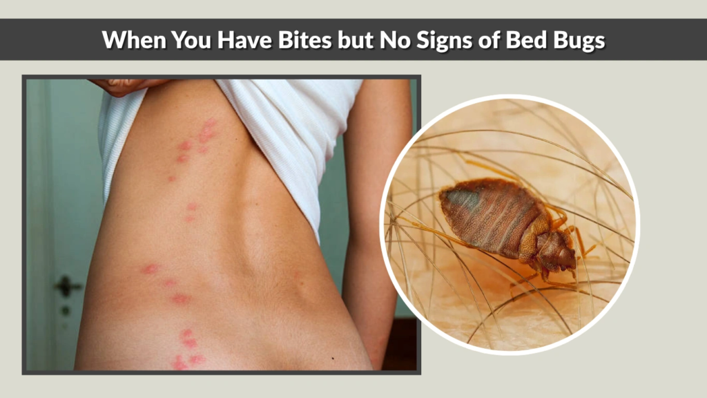 When You Have Bites but No Signs of Bed Bugs