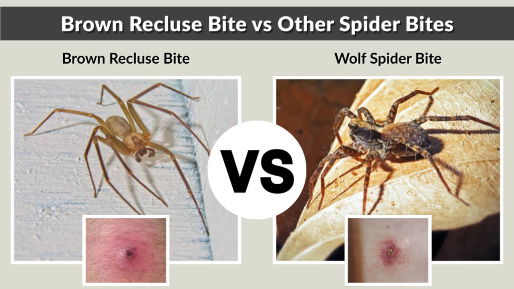 Brown Recluse Bite vs Other Spider Bites
