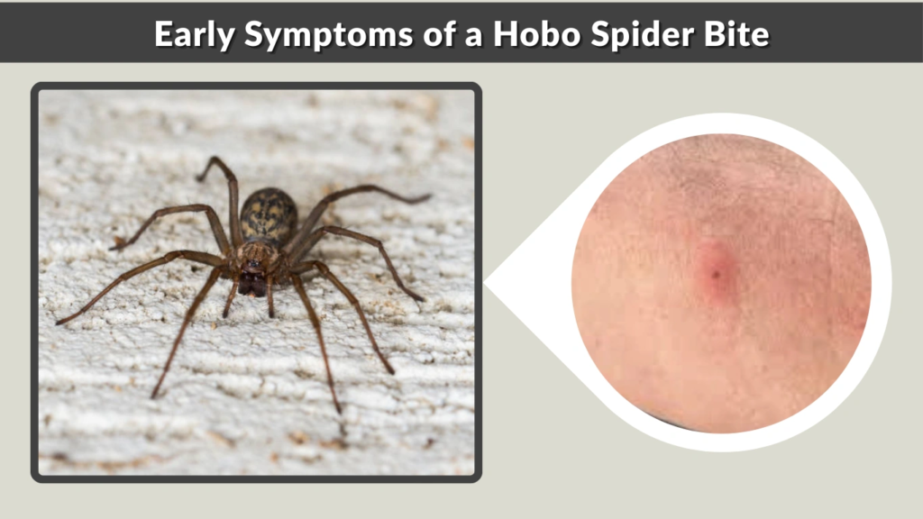 Early Symptoms of a Hobo Spider Bite