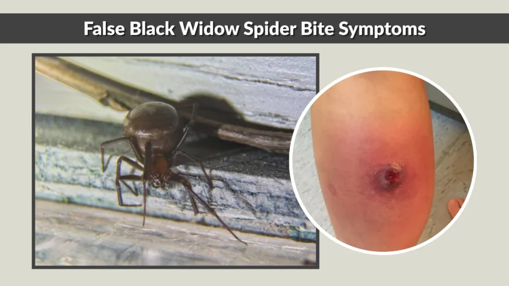 False Black Widow Spider Bite Symptoms