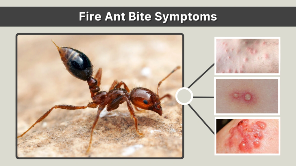 Fire Ant Bites: Symptoms, Treatment, Identification With Pictures