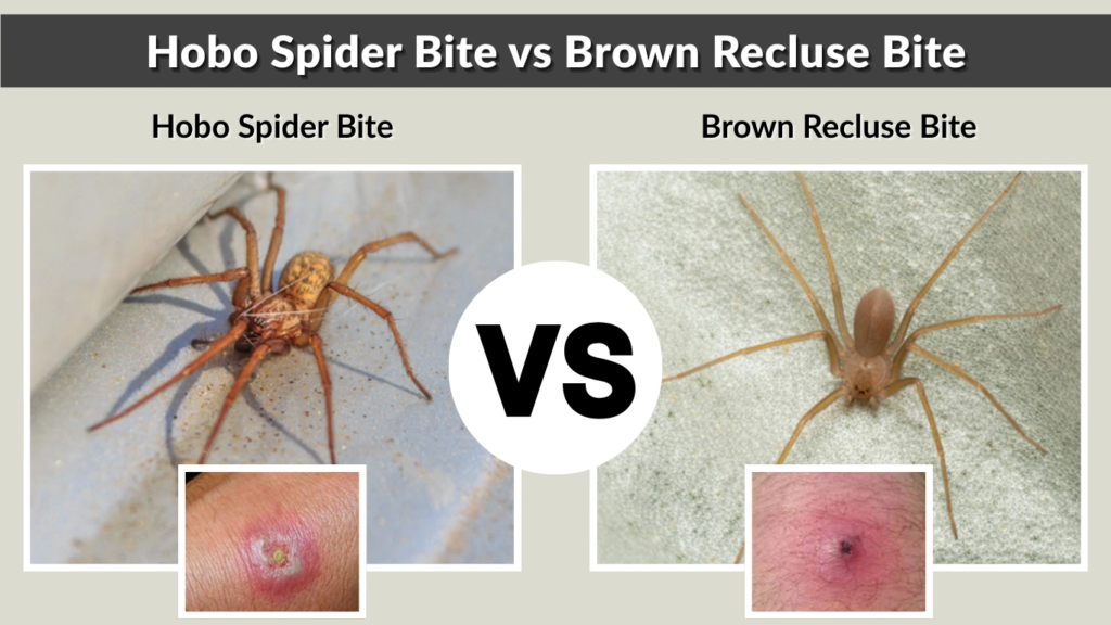 Hobo Spider Bite vs Brown Recluse Bite