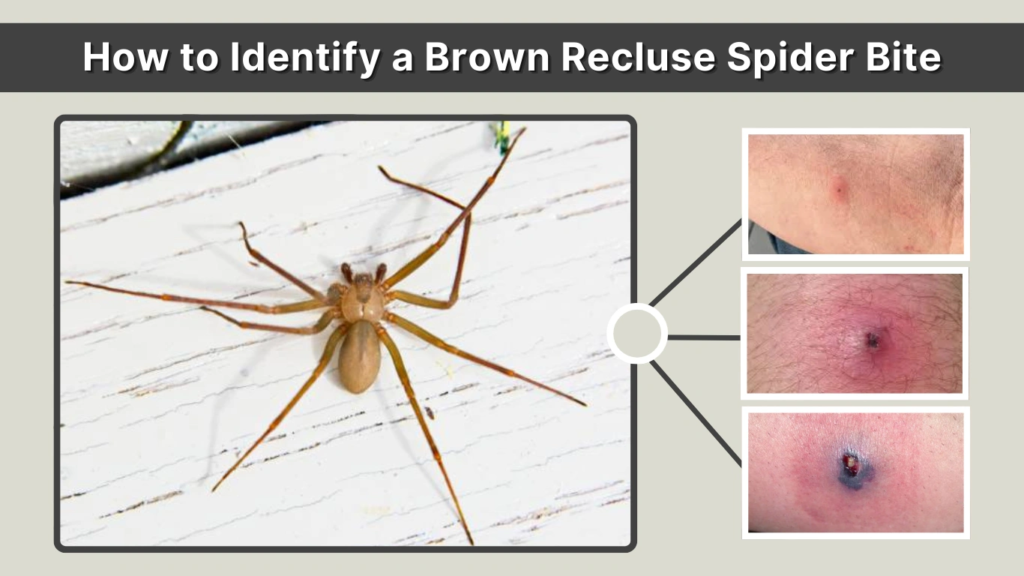 How to Identify a Brown Recluse Spider Bite