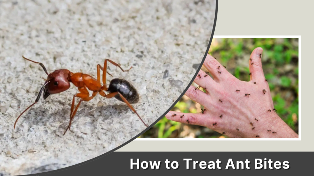 How to Treat Ant Bites