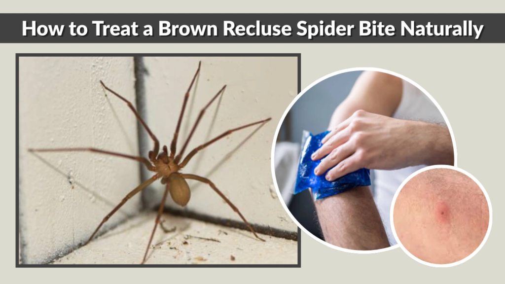 How to Treat a Brown Recluse Spider Bite Naturally