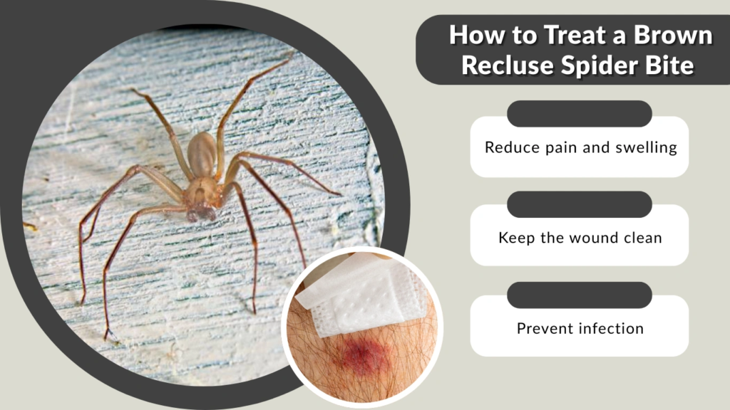 How to Treat a Brown Recluse Spider Bite (Overview)