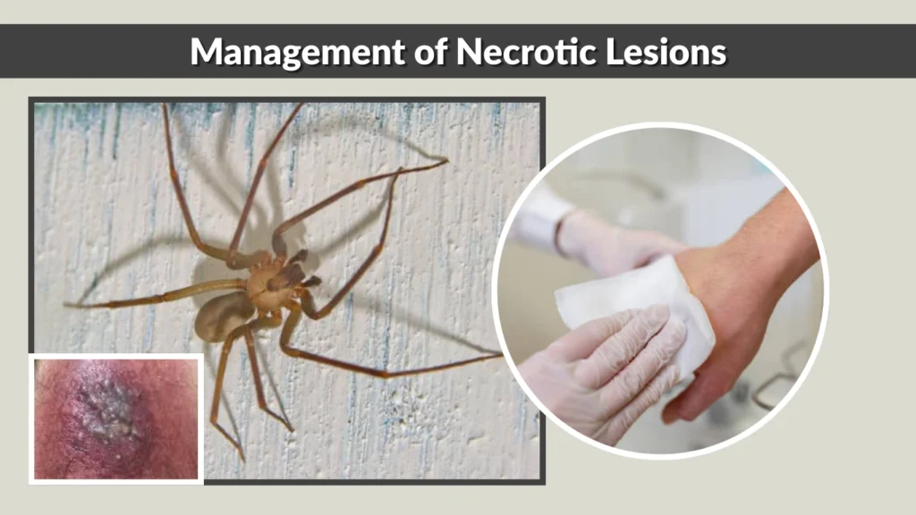 Management of Necrotic Lesions