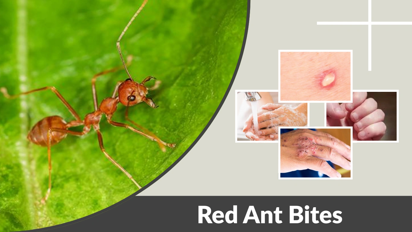 Red Ant Bites Identification, Symptoms, Treatment, and Allergic Reactions