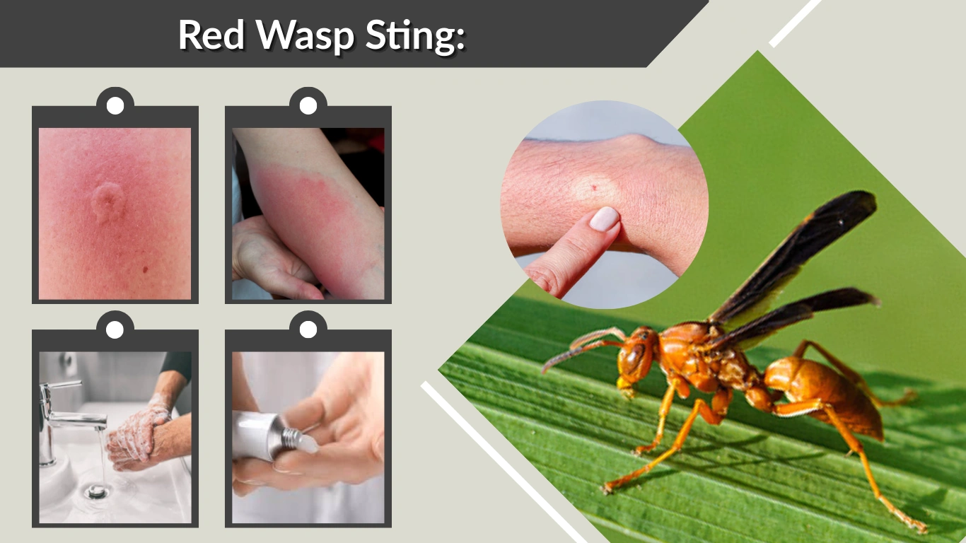 Red Wasp Sting Pain Level, Symptoms, Treatment & Relief