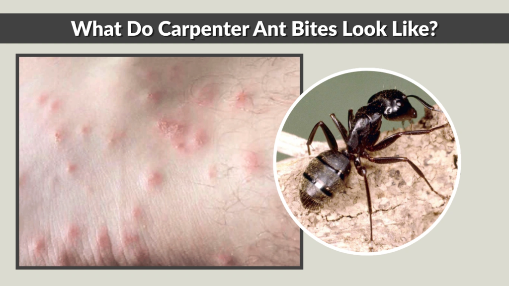 What Do Carpenter Ant Bites Look Like