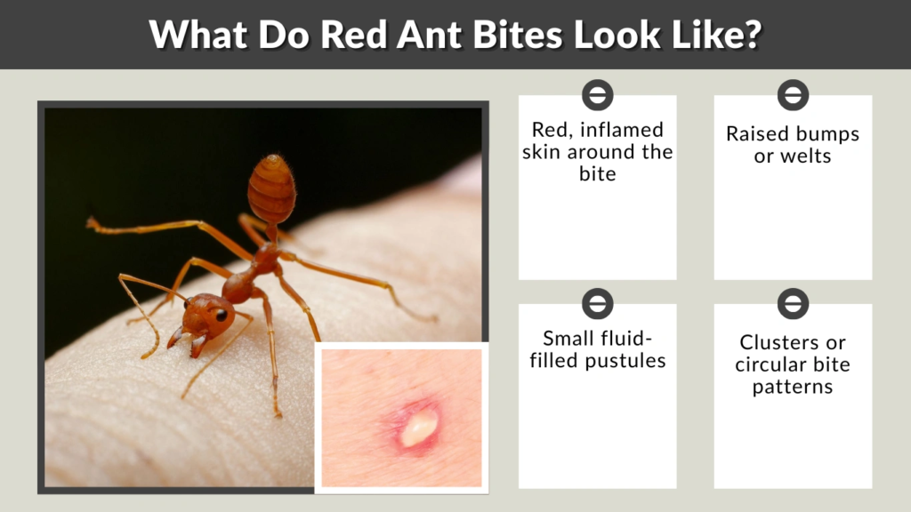 What Do Red Ant Bites Look Like