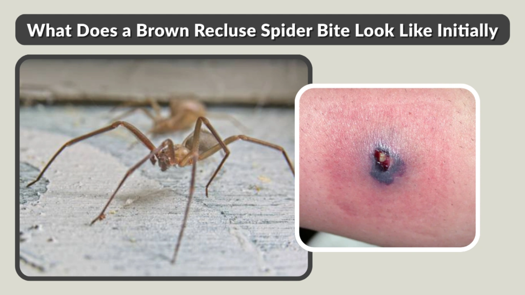 What Does a Brown Recluse Spider Bite Look Like Initially