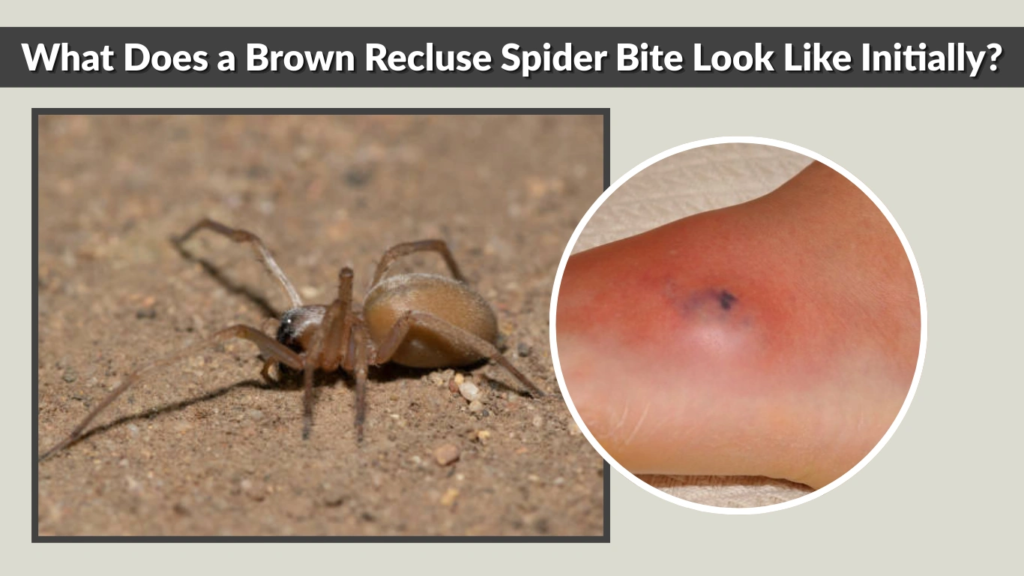 What Does a Brown Recluse Spider Bite Look Like Initially