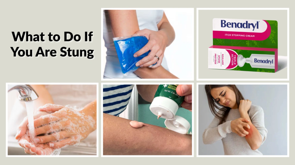 What to Do If You Are Stung