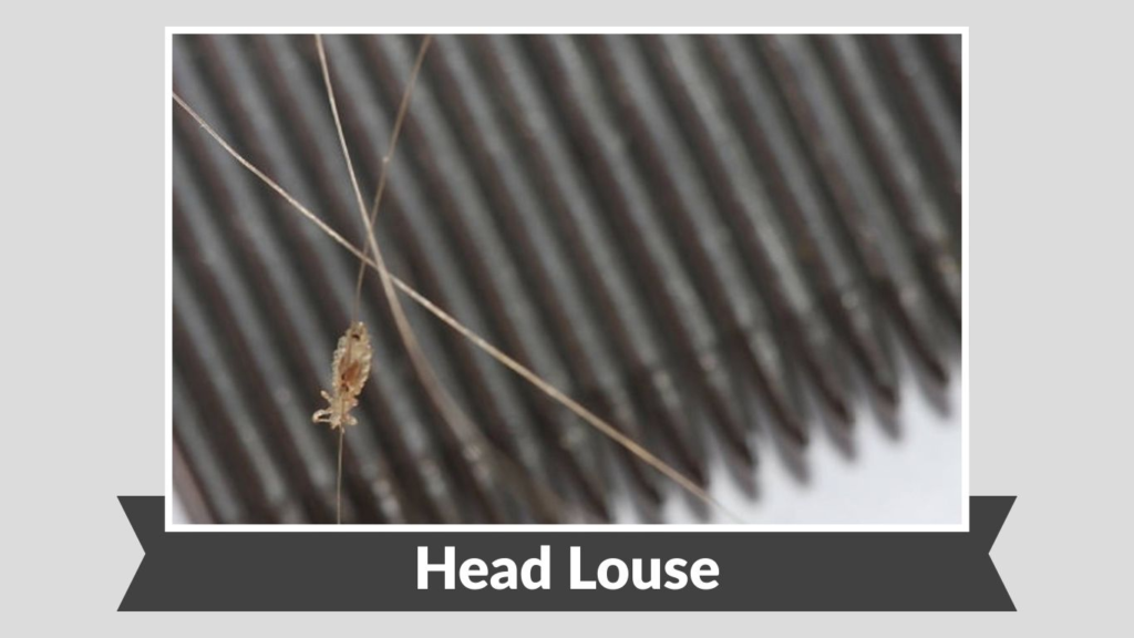  Head Louse