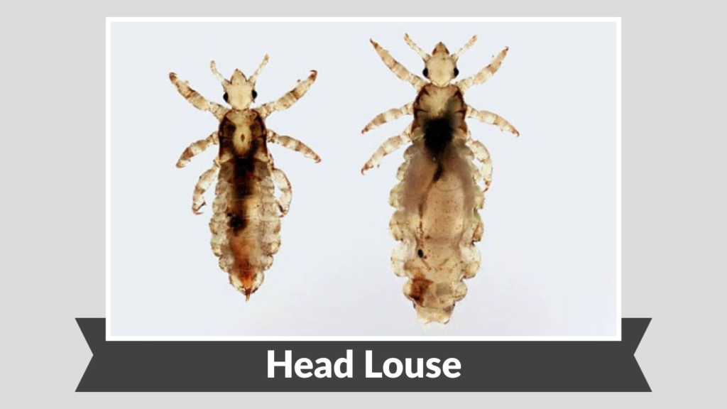 Head Louse