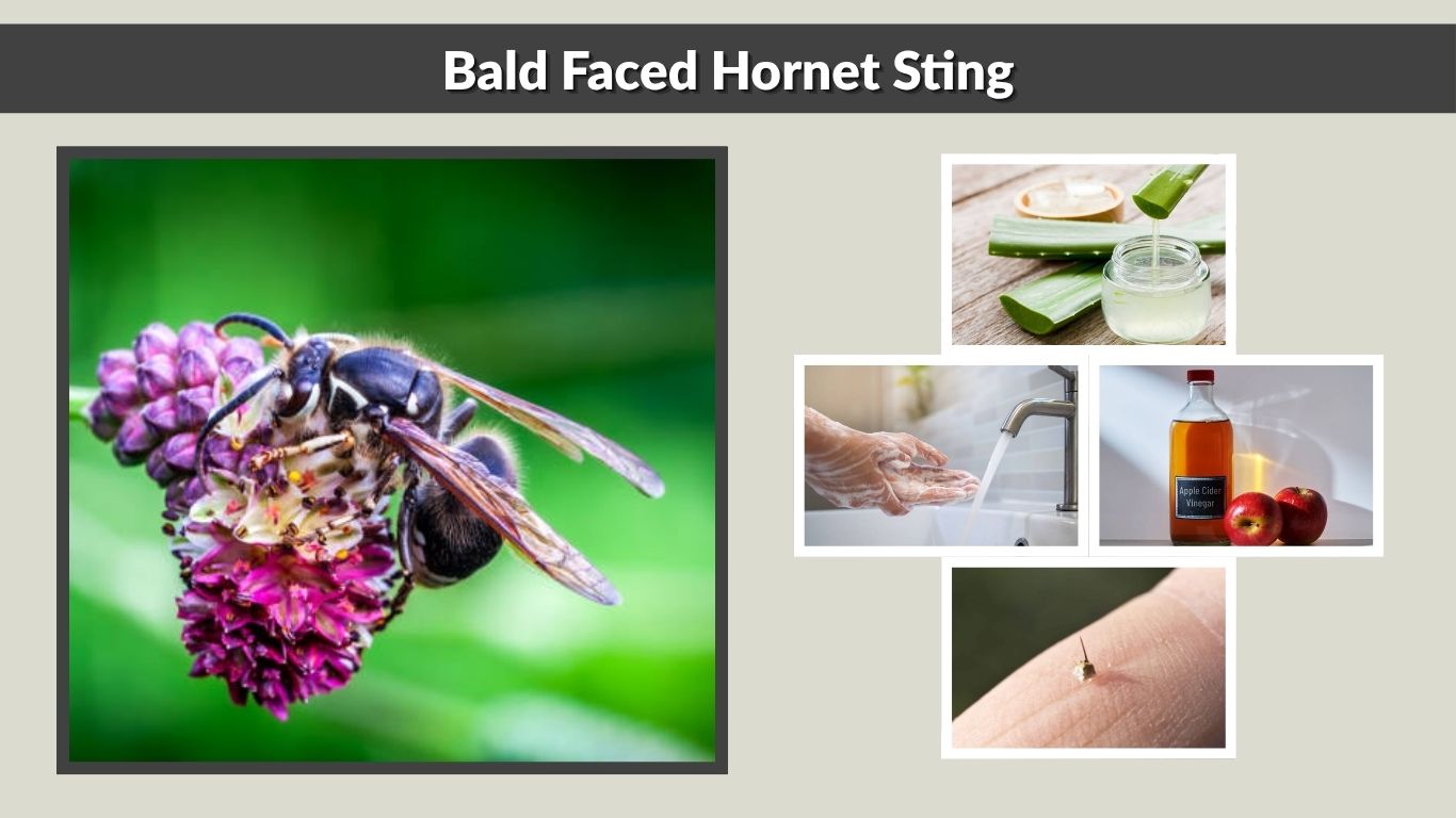Bald Faced Hornet Sting: Pain, Treatment, and Safety