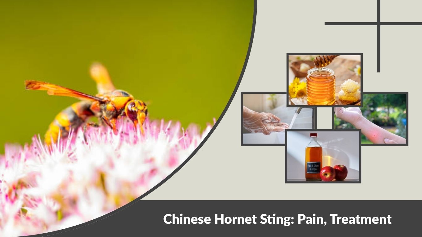 Chinese Hornet Sting: Pain, Treatment and Safety Guide
