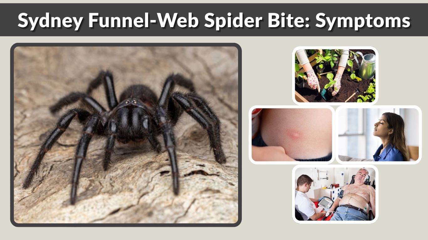 Sydney Funnel-Web Spider Bite: Symptoms, Treatment & Survival Guide