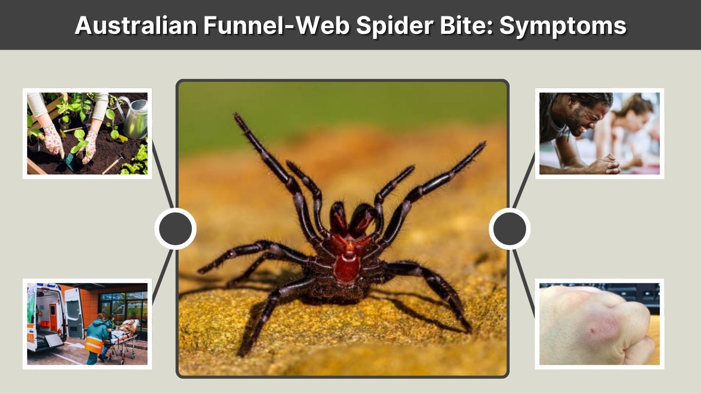 Australian Funnel-Web Spider Bite: Symptoms, Treatment & Survival Guide