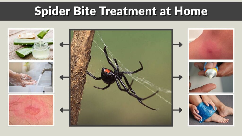 Spider Bite Treatment at Home: Step-by-Step Guide