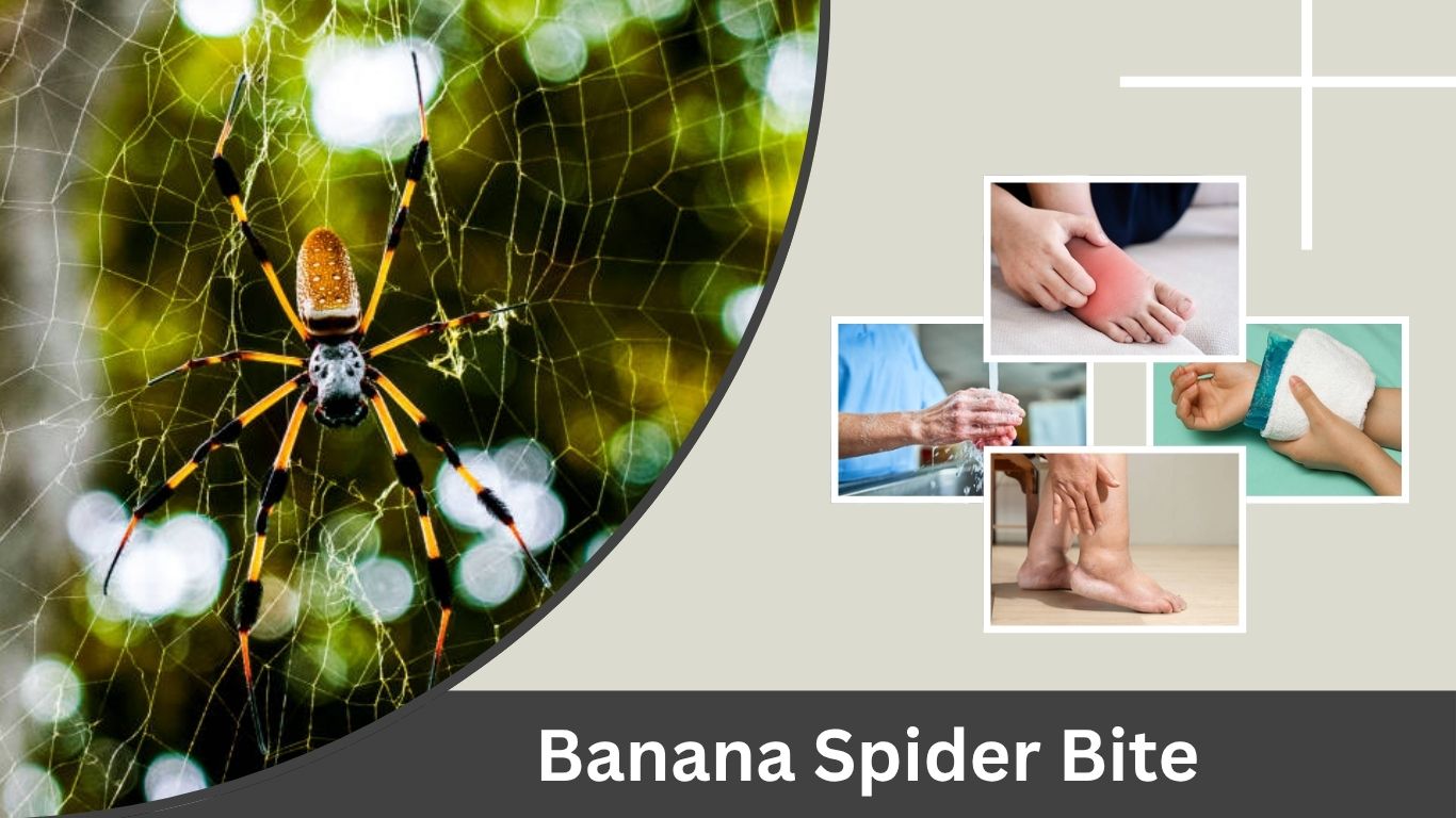 Banana Spider Bite: Symptoms, Effects & Treatment