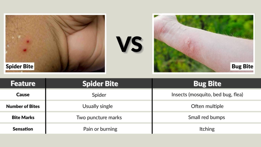 Spider Bite vs Bug Bite (Quick Comparison Table)