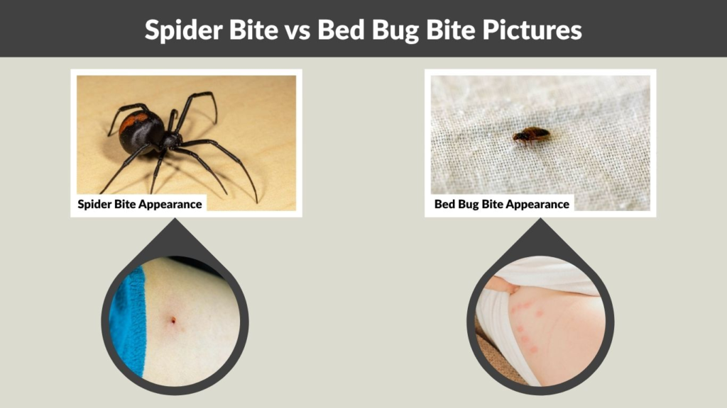 Spider Bite vs Bed Bug Bite Pictures (What It Looks Like)