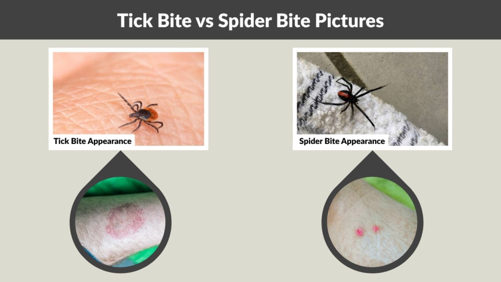 Tick Bite vs Spider Bite Pictures (What It Looks Like)