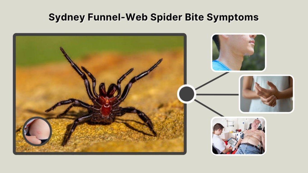 Sydney Funnel-Web Spider Bite Symptoms