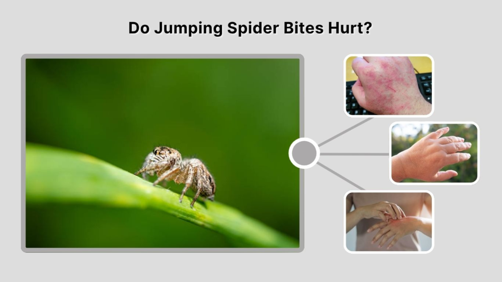 Do Jumping Spider Bites Hurt?