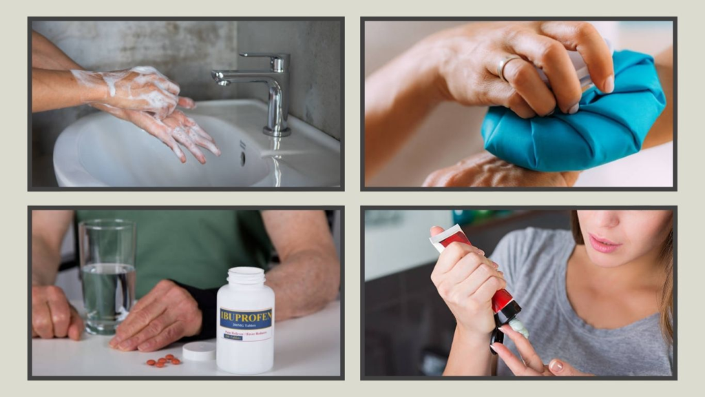 Step-by-Step Hornet Sting Treatment