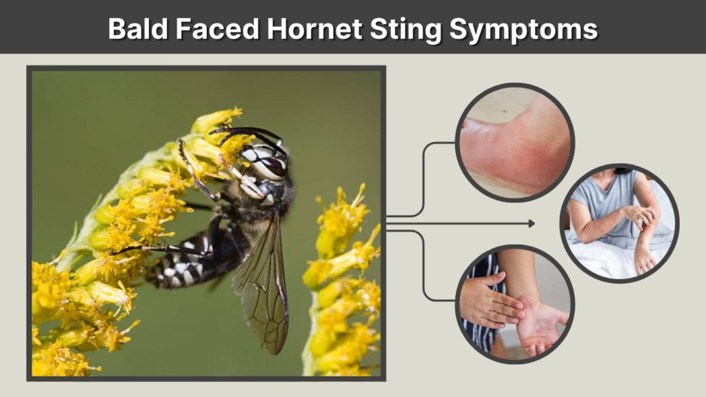 Bald Faced Hornet Sting Symptoms