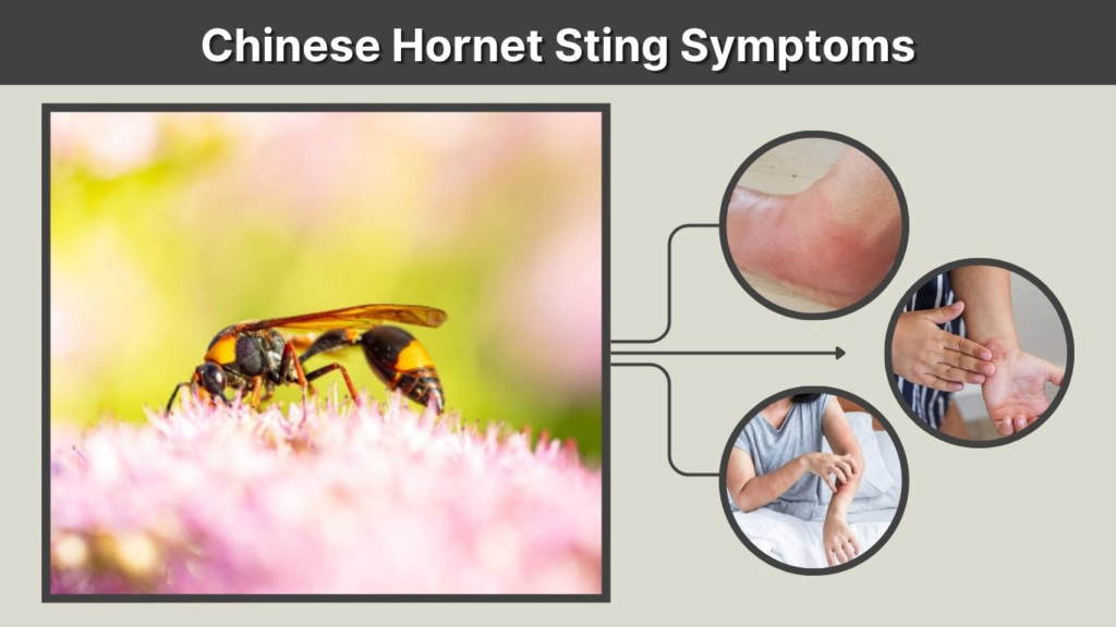 Chinese Hornet Sting Symptoms