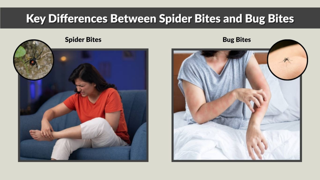 Key Differences Between Spider Bites and Bug Bites