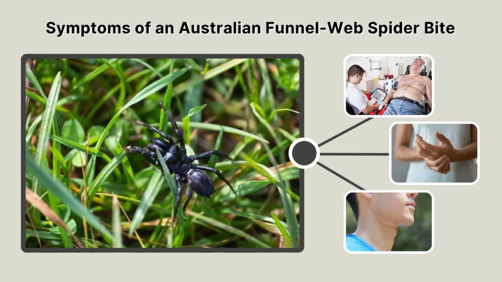 Symptoms of an Australian Funnel-Web Spider Bite
