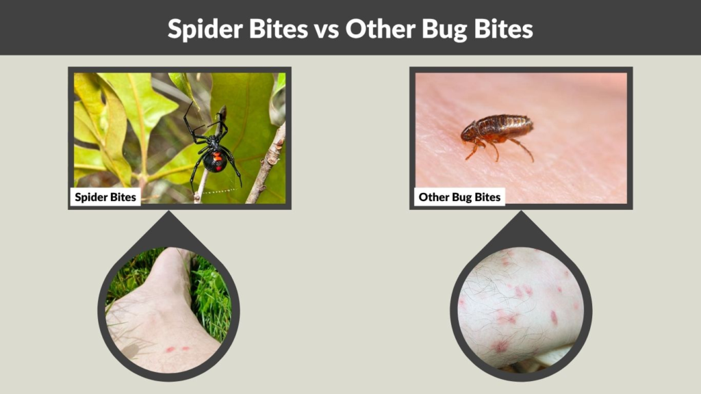 Spider Bites vs Other Bug Bites